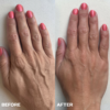 Hand Wrinkle Patches - 1 Par - Bilde 3