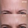 Forehead Wrinkle Patches - 2Pack - Bilde 3